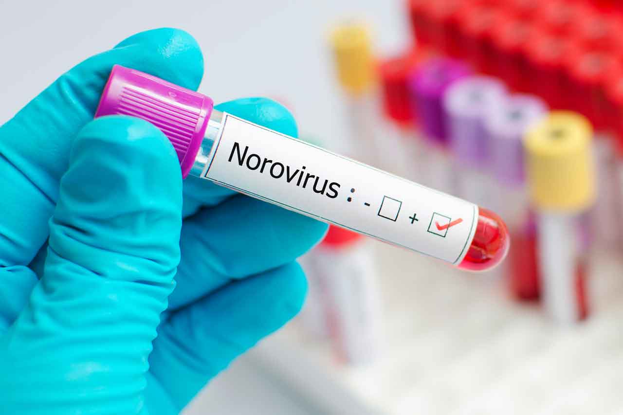 how-long-does-norovirus-last-yourcareeverywhere