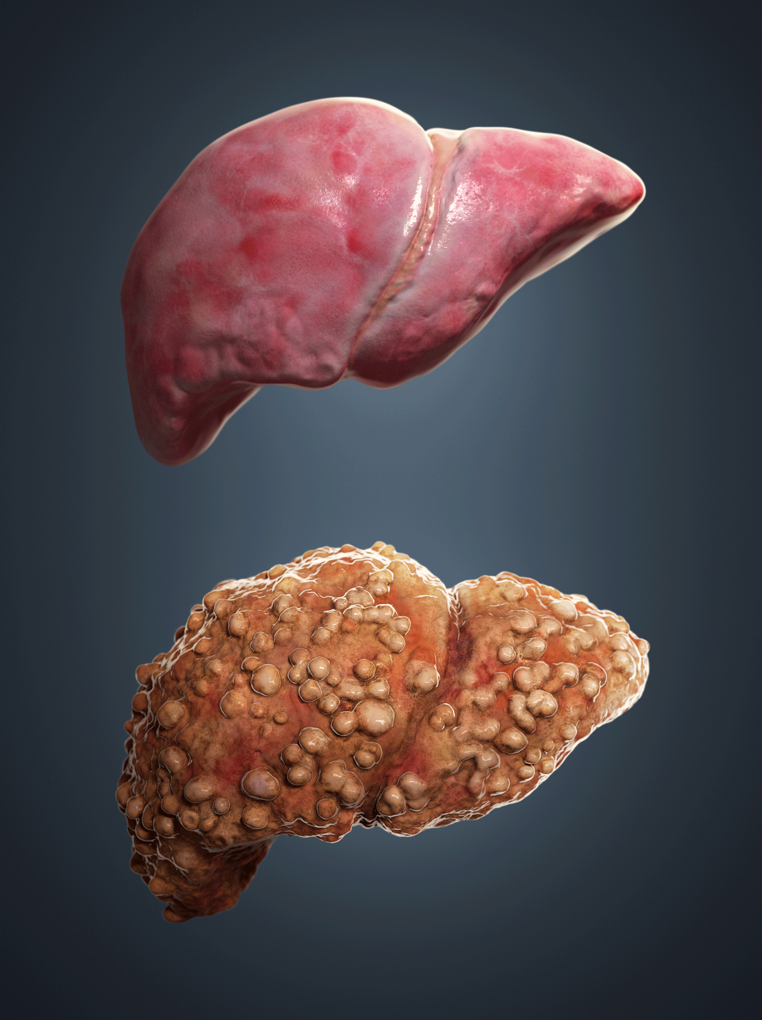 Foods To Eat If You Have A Bad Liver