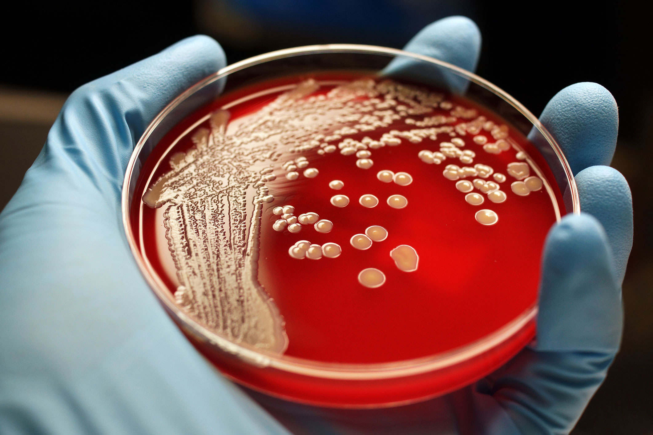 How Do You Get MRSA? YourCareEverywhere