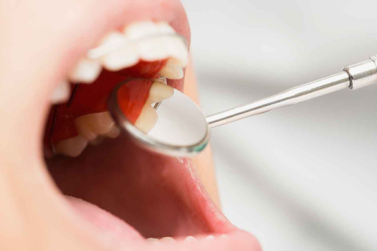 How to Keep Your Gums Healthy | YourCareEverywhere