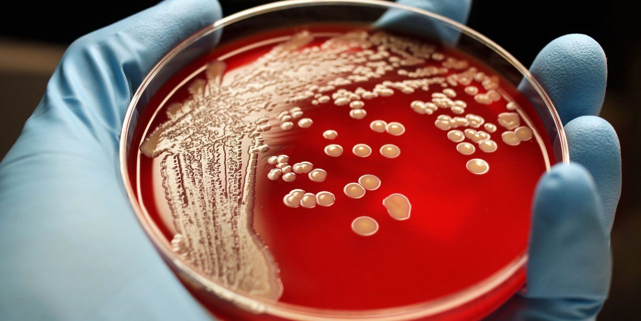 Staphylococcus aureus in Healthcare Settings, HAI