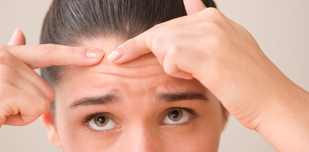 Acne hair treatment